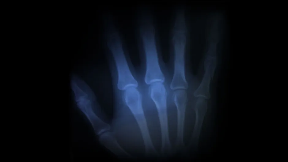 Computational Methods for Biomedical Image Analysis I Stanford Online